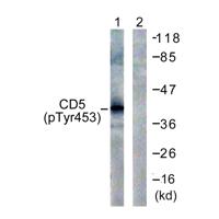 CD5 (phospho Tyr453) Polyclonal Antibody