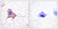 CD71/TfR (phospho Ser24) Polyclonal Antibody