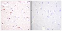 Cdc16 (phospho Ser560) Polyclonal Antibody