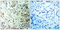 Cdc2 (phospho Thr161) Polyclonal Antibody