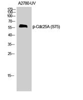 Cdc25A (phospho Ser75) Polyclonal Antibody