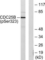 Cdc25B (phospho Ser323) Polyclonal Antibody