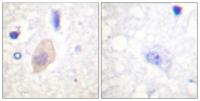 Cdc25B (phospho Ser353) Polyclonal Antibody