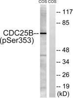 Cdc25B (phospho Ser353) Polyclonal Antibody