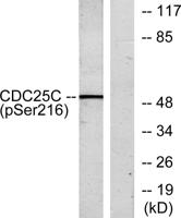 Cdc25C (phospho Ser216) Polyclonal Antibody