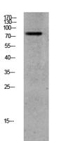 GRK2 (Phospho Ser685) Antibody