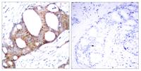 GSK3α (phospho Ser21) Polyclonal Antibody