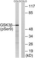 GSK3β (phospho Ser9) Polyclonal Antibody