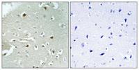 HAND1 (phospho Ser98) Polyclonal Antibody