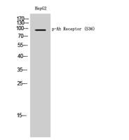 Ah Receptor (phospho Ser36) Polyclonal Antibody