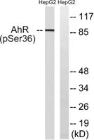 Ah Receptor (phospho Ser36) Polyclonal Antibody