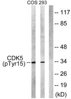 Cdk5 (phospho Tyr15) Polyclonal Antibody