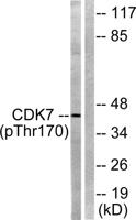 Cdk7 (phospho Thr170) Polyclonal Antibody