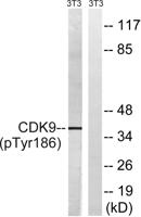 Cdk9 (phospho Thr186) Polyclonal Antibody