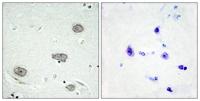 c-Fms (phospho Tyr809) Polyclonal Antibody