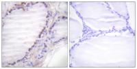 c-Fos (phospho Ser362) Polyclonal Antibody