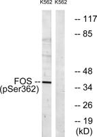 c-Fos (phospho Ser362) Polyclonal Antibody