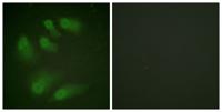 Chk1 (phospho Ser286) Polyclonal Antibody