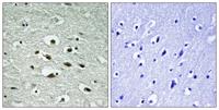 Chk1 (phospho Ser296) Polyclonal Antibody