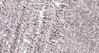 Chk1 (phospho Ser317) Polyclonal Antibody