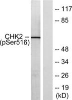 Chk2 (phospho Ser516) Polyclonal Antibody