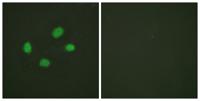 Chk2 (phospho Thr383) Polyclonal Antibody