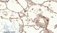 Chk2 (phospho Thr68) Polyclonal Antibody