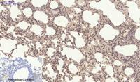 Chk2 (phospho Thr68) Polyclonal Antibody