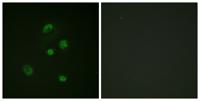 CHOP (phospho Ser30) Polyclonal Antibody