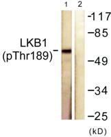 LKB1 (phospho Thr189) Polyclonal Antibody