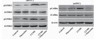 LIMK-2 (phospho Thr505) Polyclonal Antibody