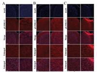 LIMK-1/2 (phospho Thr508/505) Polyclonal Antibody