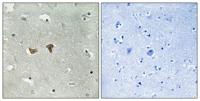 Lfc (phospho Ser886) Polyclonal Antibody