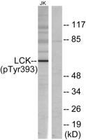 Lck (phospho Tyr393) Polyclonal Antibody