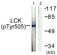 Lck (phospho Tyr505) Polyclonal Antibody