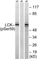 Lck (phospho Ser540) Polyclonal Antibody