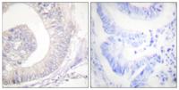 HSL (phospho Ser855) Polyclonal Antibody