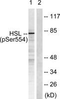 HSL (phospho Ser855) Polyclonal Antibody