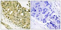 Op18 (phospho Ser62) Polyclonal Antibody