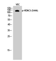 HDAC5 (phospho Ser498) Polyclonal Antibody