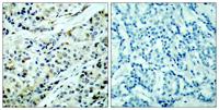 HDAC5 (phospho Ser498) Polyclonal Antibody