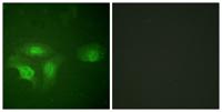 HDAC6 (phospho Ser22) Polyclonal Antibody