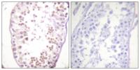 HDAC6 (phospho Ser22) Polyclonal Antibody