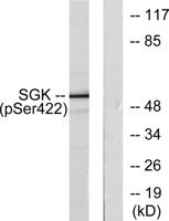 SGK1 (phospho Ser422) Polyclonal Antibody