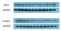 SGK1 (phospho Ser422) Polyclonal Antibody