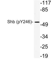 Shb (phospho Tyr246) Polyclonal Antibody