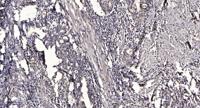 Shb (phospho Tyr246) Polyclonal Antibody