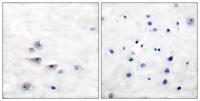 Shc (phospho Tyr427) Polyclonal Antibody