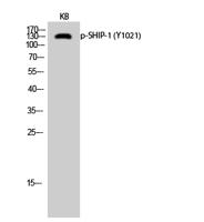 SHIP-1 (phospho Tyr1021) Polyclonal Antibody