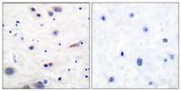 SH-PTP2 (phospho Tyr580) Polyclonal Antibody